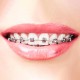 The PRESIDENT ORTHODONTIC toothbrush 